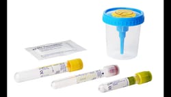 BD Vacutainer&trade;&nbsp;Urine Complete Cup Kit, 3 Tube, Conventional Stopper