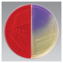 Thermo Scientific&trade;&nbsp;Remel&trade; Biplates: Anaerobic Reducible through Levine Agars