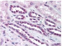 Phospho-NFkB (RelA) (Ser276)Rabbit anti-Human, Polyclonal, Rockland 100