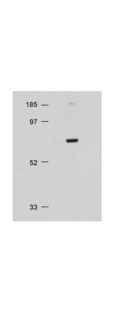 AKT Polyclonal Antibody, Rockland:Antibodies:Primary Antibodies