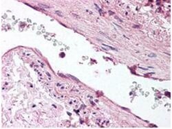 Angiopoietin 1 Polyclonal Antibody, Rockland:Antibodies:Primary Antibodies