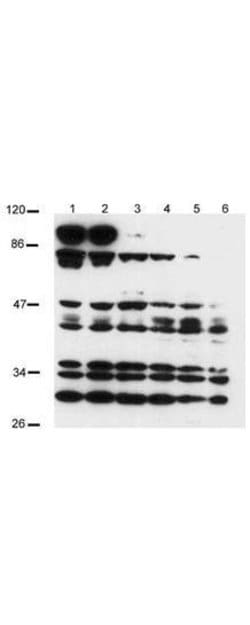 NOTCH 2Rabbit anti-Canine, Chimpanzee, Human, Polyclonal, Rockland 200