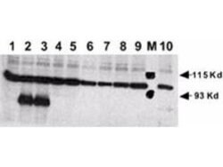 NOTCH 1 Polyclonal Antibody, Rockland 25 &mu;L; Unconjugated:Antibodies,