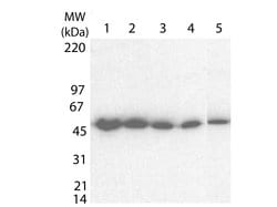 Tetanus Toxic Fragment C Polyclonal Antibody, Rockland:Antibodies:Primary