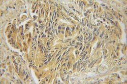 Marcks Rabbit anti-Mouse, Polyclonal, Proteintech 150 &mu;L; Unconjugated:Antibodies,