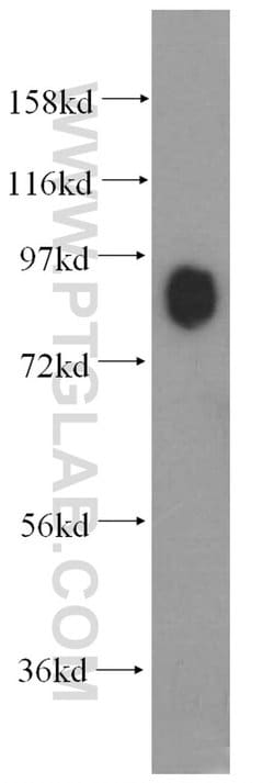 Marcks Rabbit anti-Mouse, Polyclonal, Proteintech 150 &mu;L; Unconjugated:Antibodies,