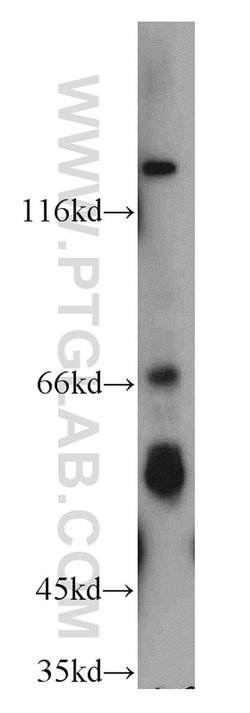 cIAP1 Rabbit anti-Human, Mouse, Polyclonal, Proteintech 20 &mu;L; Unconjugated:Antibodies,