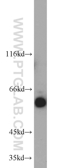 cIAP1 Rabbit anti-Human, Mouse, Polyclonal, Proteintech 20 &mu;L; Unconjugated:Antibodies,
