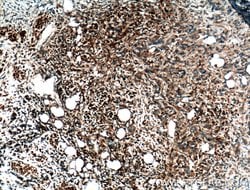 JNK Rabbit anti-Human, Mouse, Rat, Polyclonal, Proteintech:Antibodies:Primary