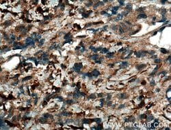 JNK Rabbit anti-Human, Mouse, Rat, Polyclonal, Proteintech:Antibodies:Primary