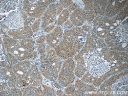 JNK Rabbit anti-Human, Mouse, Rat, Polyclonal, Proteintech:Antibodies:Primary