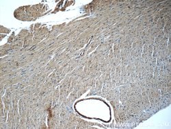 JNK Rabbit anti-Human, Mouse, Rat, Polyclonal, Proteintech:Antibodies:Primary