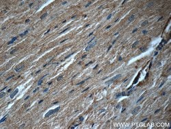JNK Rabbit anti-Human, Mouse, Rat, Polyclonal, Proteintech:Antibodies:Primary