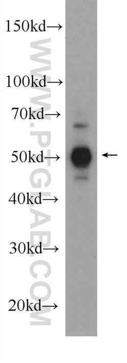 JNK Rabbit anti-Human, Mouse, Rat, Polyclonal, Proteintech:Antibodies:Primary