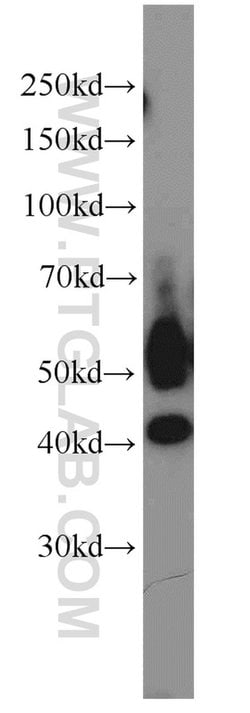 JNK Rabbit anti-Human, Mouse, Rat, Polyclonal, Proteintech:Antibodies:Primary
