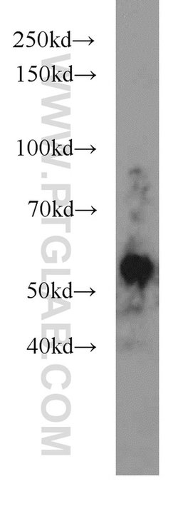 JNK Rabbit anti-Human, Mouse, Rat, Polyclonal, Proteintech:Antibodies:Primary