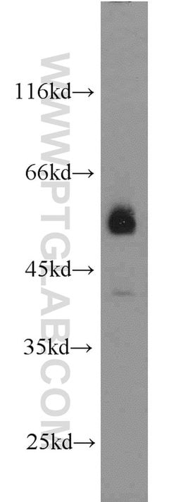 JNK Rabbit anti-Human, Mouse, Rat, Polyclonal, Proteintech:Antibodies:Primary