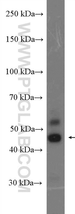 JNK Rabbit anti-Human, Mouse, Rat, Polyclonal, Proteintech:Antibodies:Primary