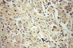 JNK Rabbit anti-Human, Mouse, Rat, Polyclonal, Proteintech:Antibodies:Primary