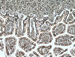 PDK1 Rabbit anti-Human, Mouse, Polyclonal, Proteintech:Anticuerpos:Anticuerpos