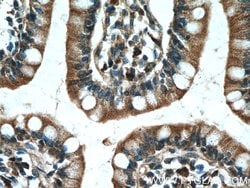 PDK1 Rabbit anti-Human, Mouse, Polyclonal, Proteintech:Anticuerpos:Anticuerpos