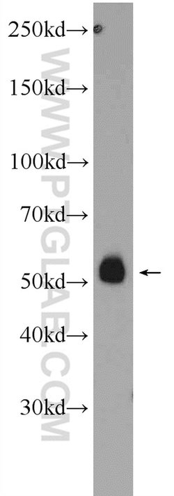 PDK1 Rabbit anti-Human, Mouse, Polyclonal, Proteintech:Anticuerpos:Anticuerpos