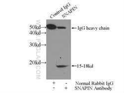 SNAPIN Rabbit anti-Human, Mouse, Rat, Polyclonal, Proteintech 20 &mu;L;
