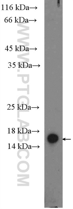 SNAPIN Rabbit anti-Human, Mouse, Rat, Polyclonal, Proteintech 20 &mu;L;