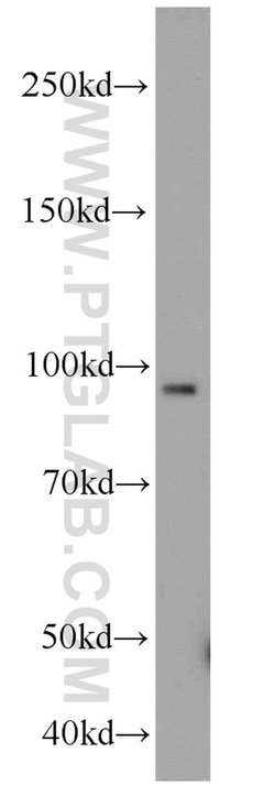 Importin beta Rabbit anti-Human, Mouse, Rat, Polyclonal, Proteintech 150
