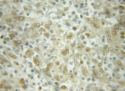 Importin beta Rabbit anti-Human, Mouse, Rat, Polyclonal, Proteintech 150