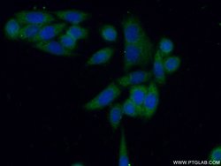 PKM Rabbit anti-Human, Mouse, Polyclonal, Proteintech:Antibodies:Primary