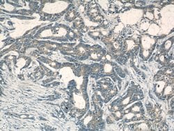 PKM Rabbit anti-Human, Mouse, Polyclonal, Proteintech:Antibodies:Primary