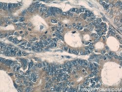 PKM Rabbit anti-Human, Mouse, Polyclonal, Proteintech:Antibodies:Primary