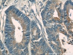 PKM Rabbit anti-Human, Mouse, Polyclonal, Proteintech:Antibodies:Primary