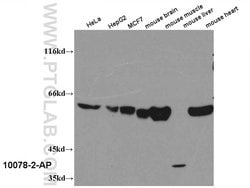 PKM Rabbit anti-Human, Mouse, Polyclonal, Proteintech:Antibodies:Primary
