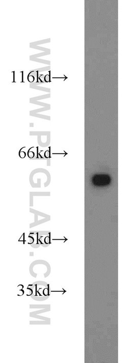 PKM Rabbit anti-Human, Mouse, Polyclonal, Proteintech:Antibodies:Primary