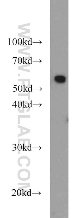 PKM Rabbit anti-Human, Mouse, Polyclonal, Proteintech:Antibodies:Primary