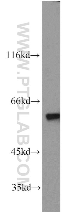PKM Rabbit anti-Human, Mouse, Polyclonal, Proteintech:Antibodies:Primary