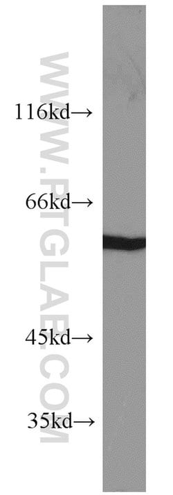 PKM Rabbit anti-Human, Mouse, Polyclonal, Proteintech:Antibodies:Primary