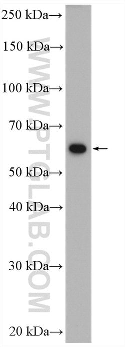 PKM Rabbit anti-Human, Mouse, Polyclonal, Proteintech:Antibodies:Primary
