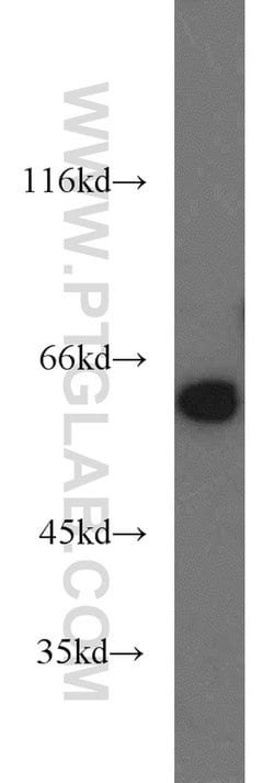 PKM Rabbit anti-Human, Mouse, Polyclonal, Proteintech:Antibodies:Primary