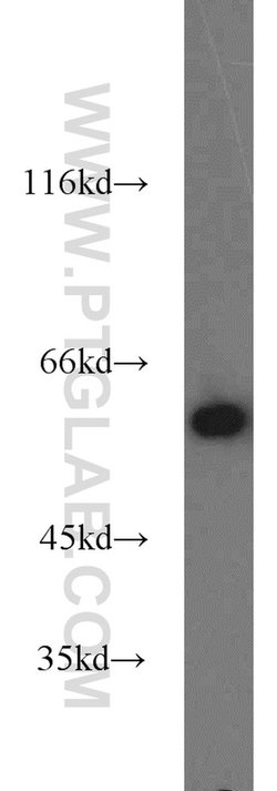 PKM Rabbit anti-Human, Mouse, Polyclonal, Proteintech:Antibodies:Primary