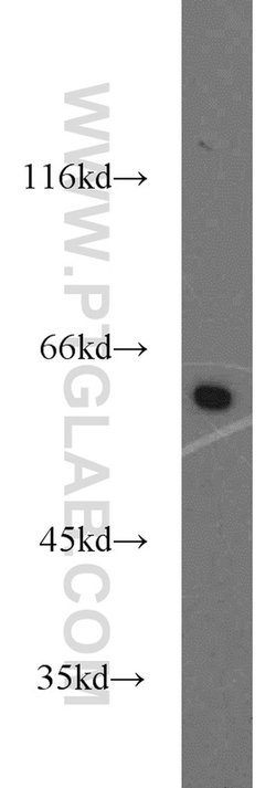 PKM Rabbit anti-Human, Mouse, Polyclonal, Proteintech:Antibodies:Primary