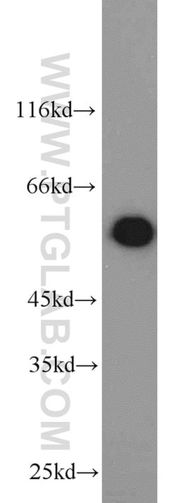 PKM Rabbit anti-Human, Mouse, Polyclonal, Proteintech:Antibodies:Primary