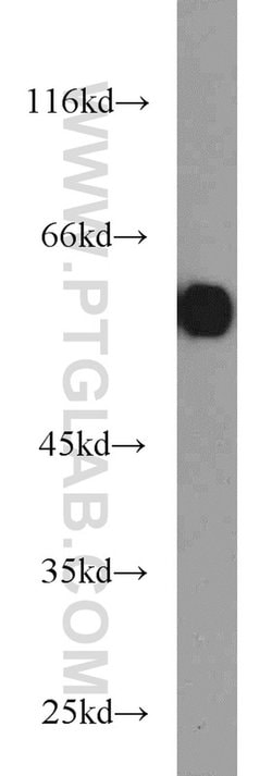 PKM Rabbit anti-Human, Mouse, Polyclonal, Proteintech:Antibodies:Primary