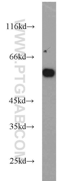 PKM Rabbit anti-Human, Mouse, Polyclonal, Proteintech:Antibodies:Primary