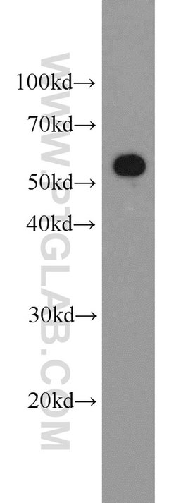 PKM Rabbit anti-Human, Mouse, Polyclonal, Proteintech:Antibodies:Primary