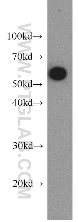 PKM Rabbit anti-Human, Mouse, Polyclonal, Proteintech:Antibodies:Primary
