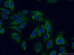 PITRM1 Rabbit anti-Human, Mouse, Rat, Polyclonal, Proteintech 150 &mu;L;