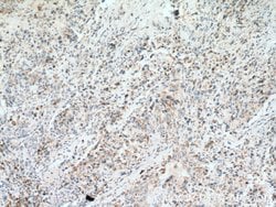 PITRM1 Rabbit anti-Human, Mouse, Rat, Polyclonal, Proteintech 150 &mu;L;